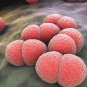 Lactobacillus casei
