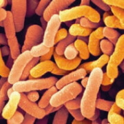 Lactococcus lactis